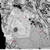 1F5 Oligodendroglia, satelliting (Case 5) EM 6 - Copy copy