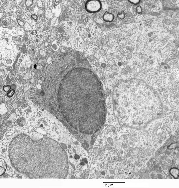 1H1 Normal Cerebral Cortex (Case 6) EM 050 - Copy