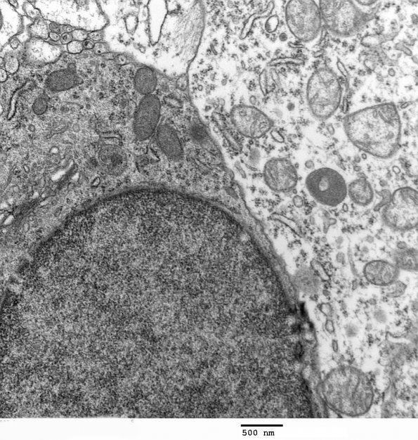 1H2 Normal Cerebral Cortex (Case 6) EM 051 - Copy