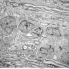 2A1 Oligodendroglia, optic nerve, mouse (R14-91E) A489 EM 002 (2) - Copy
