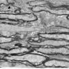 2A3-Oligodendroglia-optic-nerve-mouse-R14-91E-A489-EM-EM-016.jpg