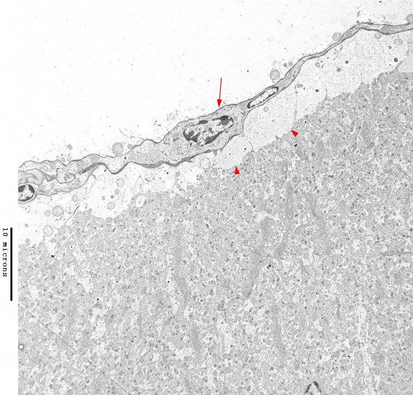 PIA EM iPLA2beta WT Cerebellum (06-211A) EM 24 copy - Copy