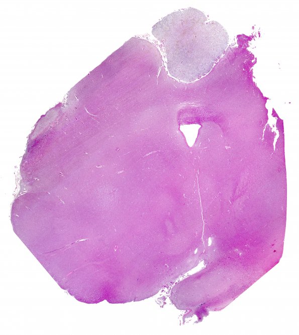 7A1 Pineal gland, sea lion (18281) H&E whole mount