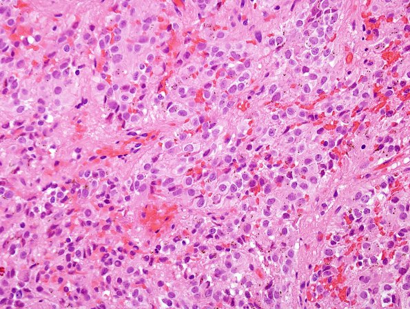 8A1 Pineal, normal (Case 7) H&E A