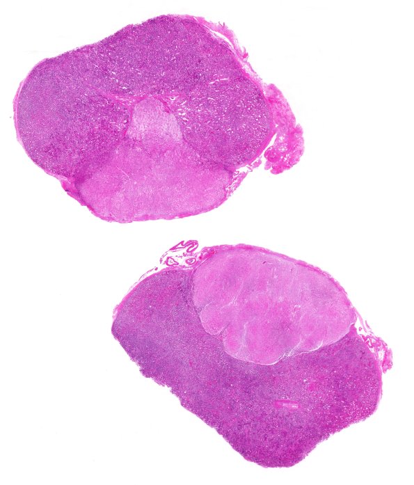 1C Pituitary, normal H&E whole mount