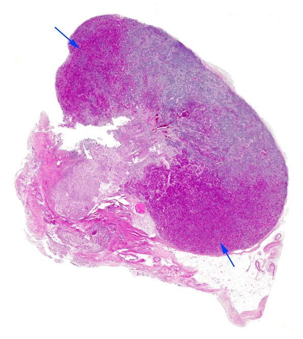 1D1 Pituitary, acidophil islands H&E whole mount copy