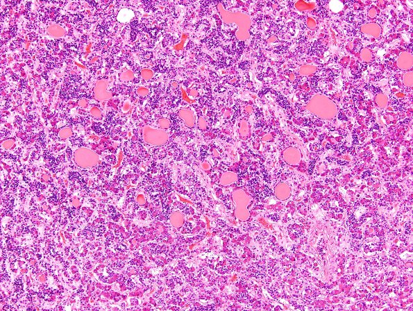3A1 Pituitary Follicles H&E 11