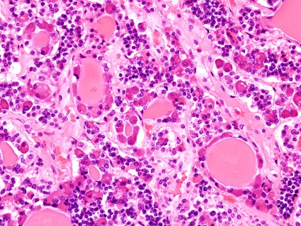 3A2 Pituitary Follicles H&E 13 (2)