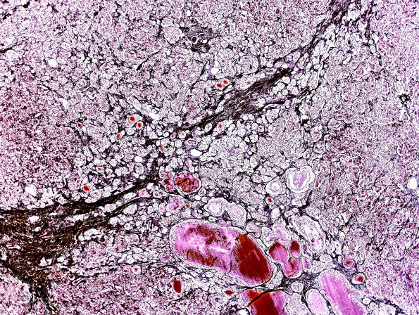 4A1 Pituitary, normal G-L Retic