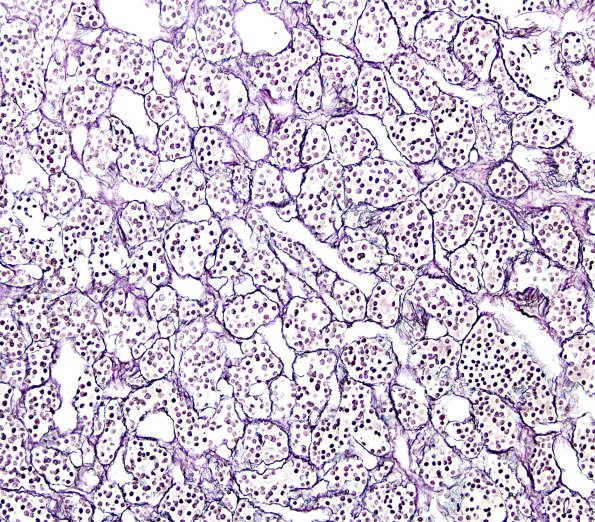 4A2 Pituitary, normal gland retic 1