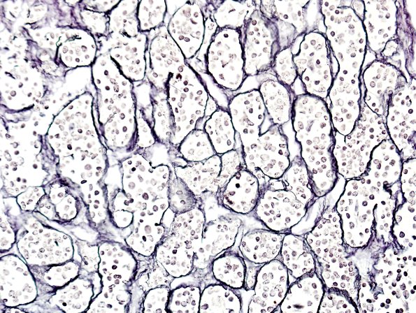 4A3 Pituitary, normal Retic 1