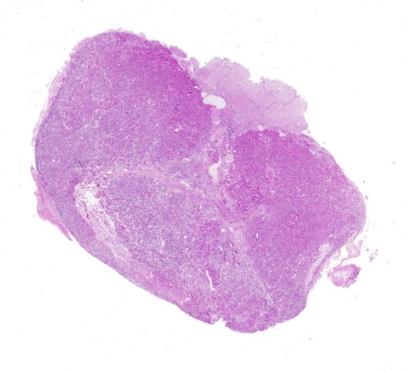 4B1 Pituitary, normal H&E whole mount