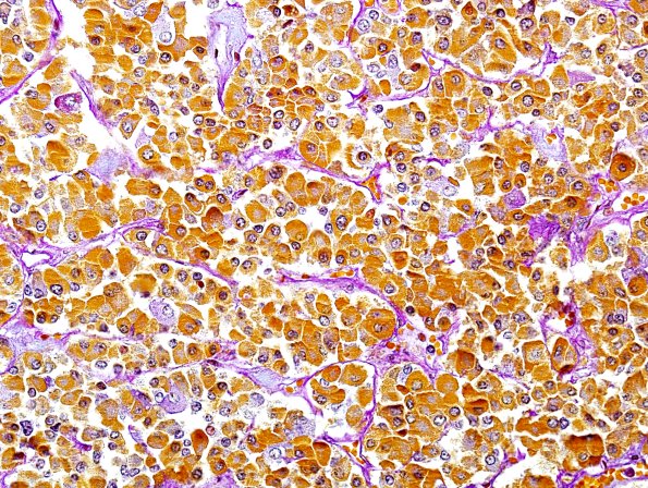 4B3 Pituitary, normal AB-PAS-H-OG 1