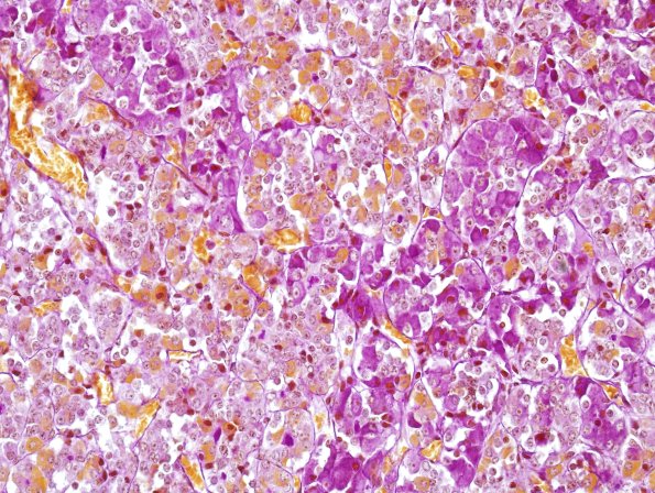 4B4 Normal Pituitary Gland PAS-Orange G 2