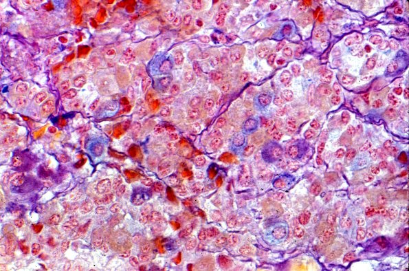 4B6 Pituitary, normal (pm-og-h-ab-pas)
