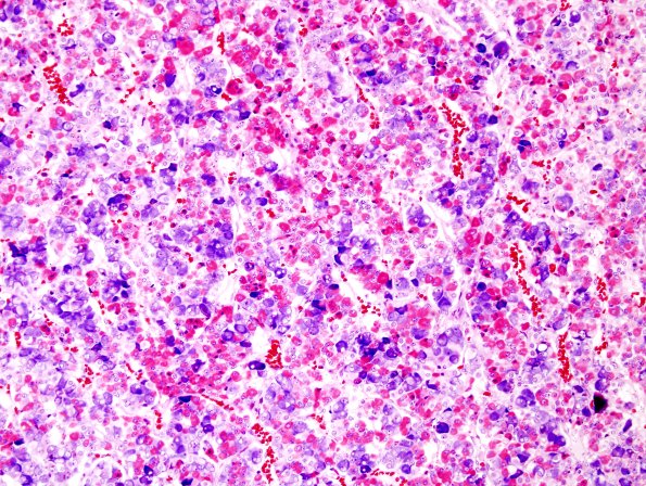 4C1 Normal Pituitary Gland Mann stain 3