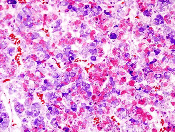 4C2 Normal Pituitary Gland Mann stain 1 (2)