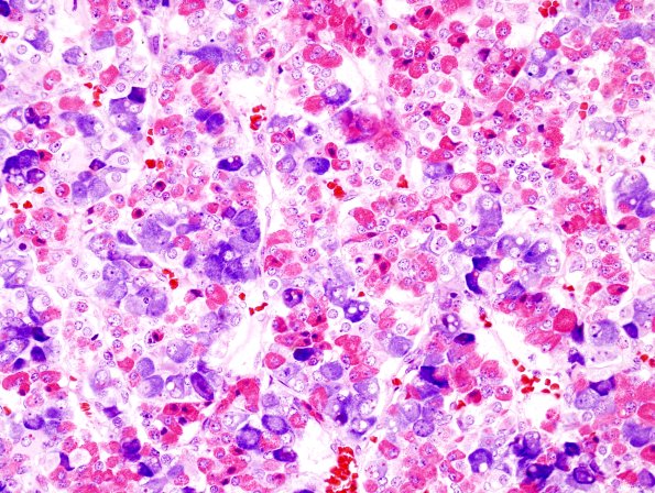 4C3 Normal Pituitary Gland Mann stain 2 (2)