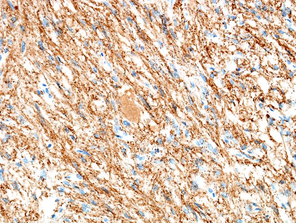 5B2 Pituitary gland normal SYN 1 (2)