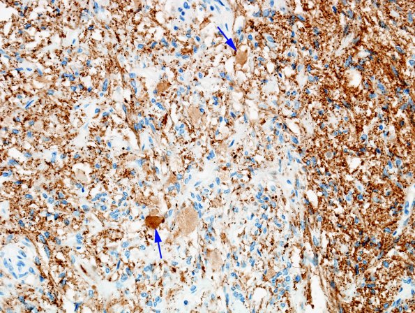 5B3 Pituitary gland normal SYN 5 copy