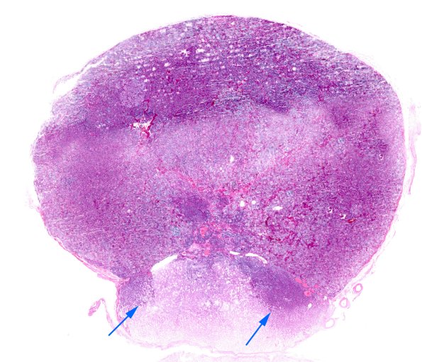 6A1 Pituitary, Normal Gland H&E 1 copy