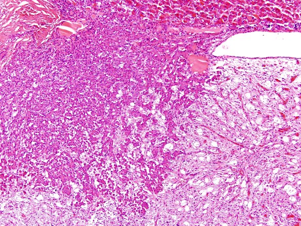 6A2 Pituitary, Normal Gland H&E 2