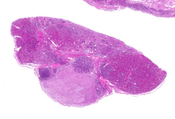 6C1 Pituitary, normal basophil invasion H&E WM