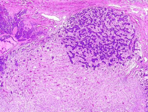 6C2 Pituitary, normal basophil invasion H&E 3
