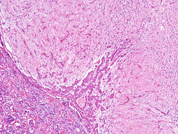 6F Pituitary, normal H&E basopil invasion