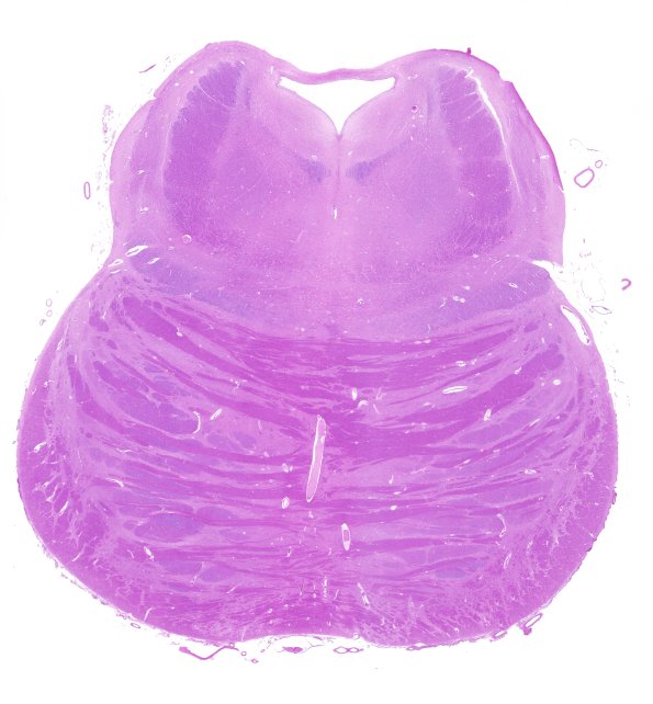 1A1 Pons, normal (Case 1) H&E whole mount