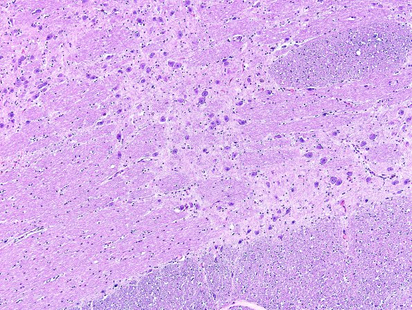 1A2 Pons, normal (Case 1A) H&E 2