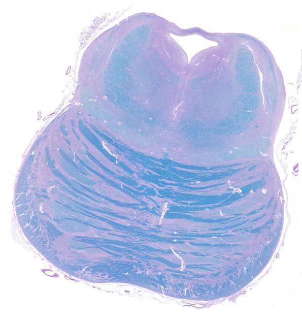 1B Pons, normal (Case 1) LFB-PAS whole mount