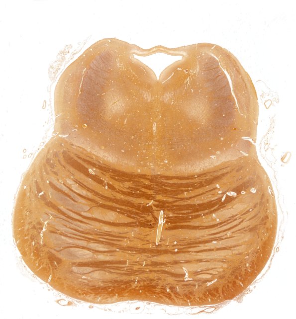 1C1Pons, normal (A12-307) Biels whole mount