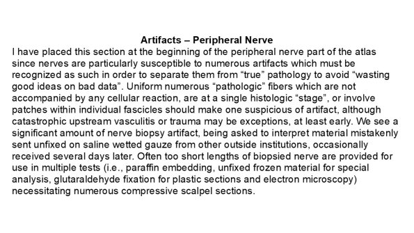 0A  Peripheral Nerve - Artifacts