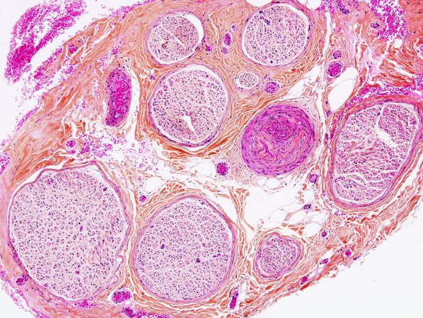 10B1 Artifact, crush Pentachrome 1