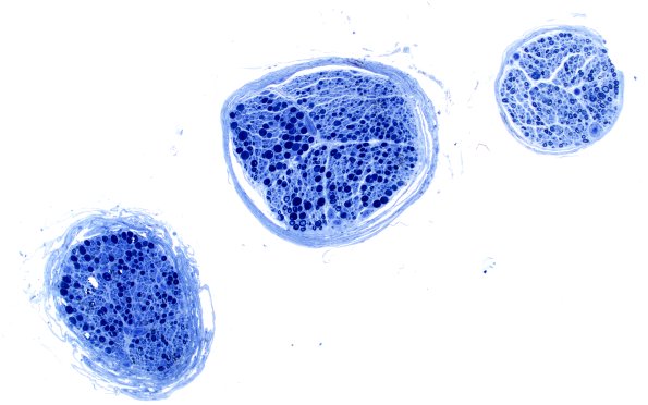 12A1 Artifact couple with cut deeper (12A2)