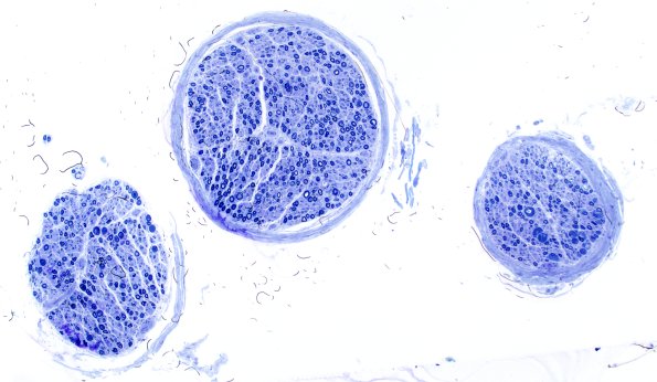 12A2 Artifact cut deeper A