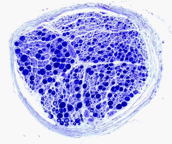 12A3 Artifact couple with cut deeper B