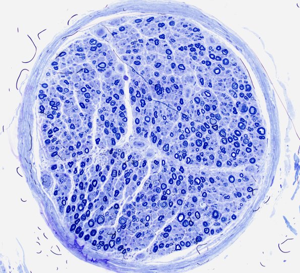 12A4 Artifact cut 50 microns deeper B