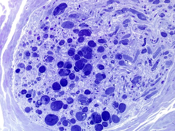 12B Artifact, crush First sections Plastic 40X 1a.jpg