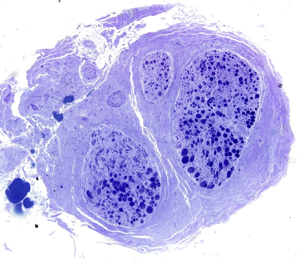 12D1 Artifact, crush First sections Plastic 10X.jpg