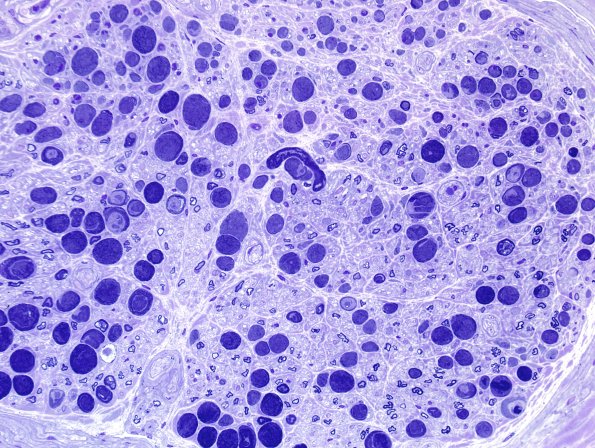 12D2 Artifact, crush First sections Plastic 40X 2a.jpg