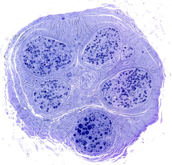 12D3 Artifact, crush Deeper sections Plastic 10X.jpg