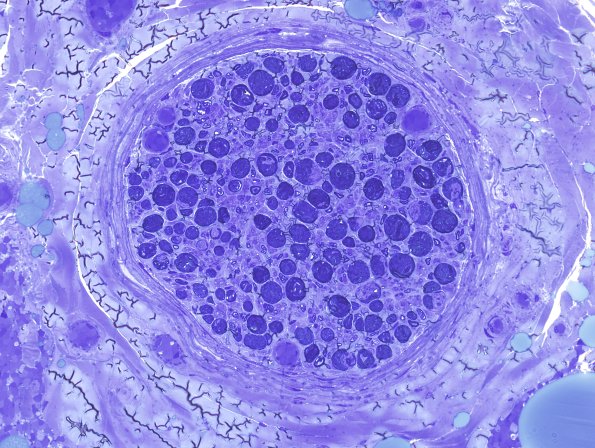 12E1 Artifact, crush Plastic 1.jpg