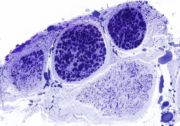 12H Crush artifact Plastic 2