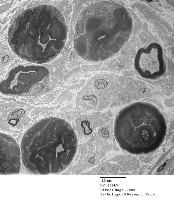 13A1 Artifact EM_003 - Copy