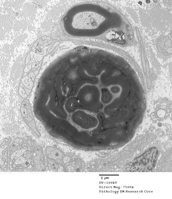 13A2 Artifact EM_031 - Copy