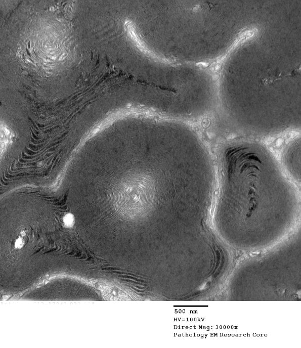 13A3 Artifact EM_033 - Copy