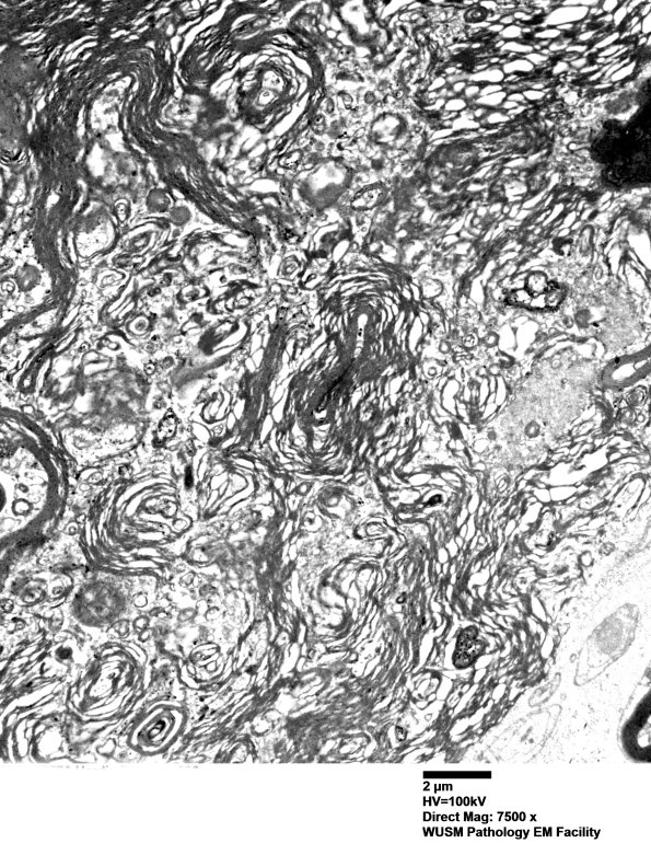 14B3 Artifact EM 006 - Copy