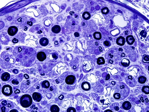 15A2 Artifact Plastic 1.jpg